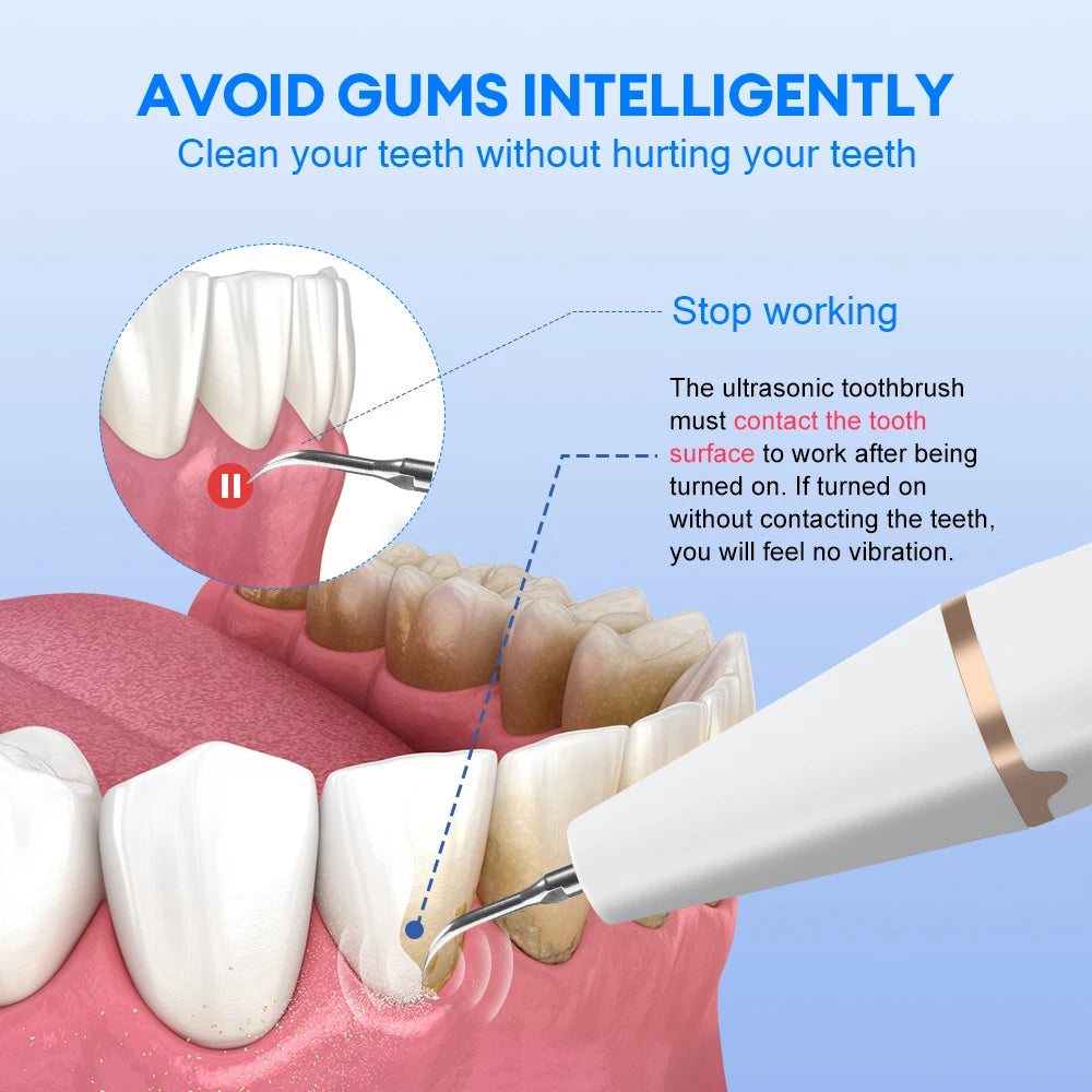 ProHome™ Ultrasonic Tooth Cleaner: Electric Plaque & Tartar Remover with LED Light